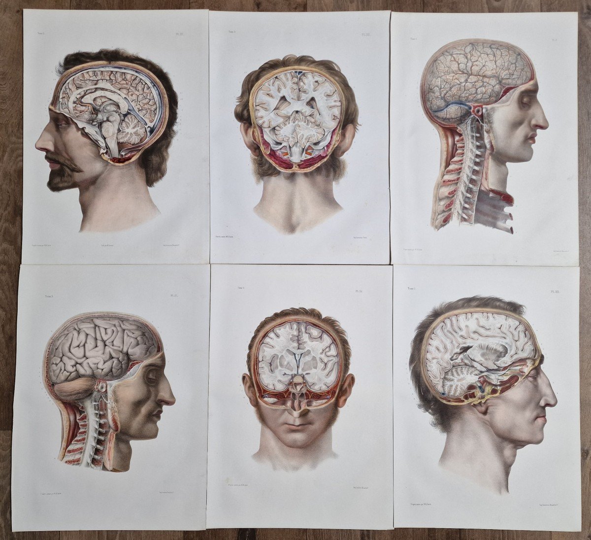 Lot De 6 Gravures Anatomiques Encéphale Par N.h Jacob Traité Anatomique Bourgery Lithographies-photo-4