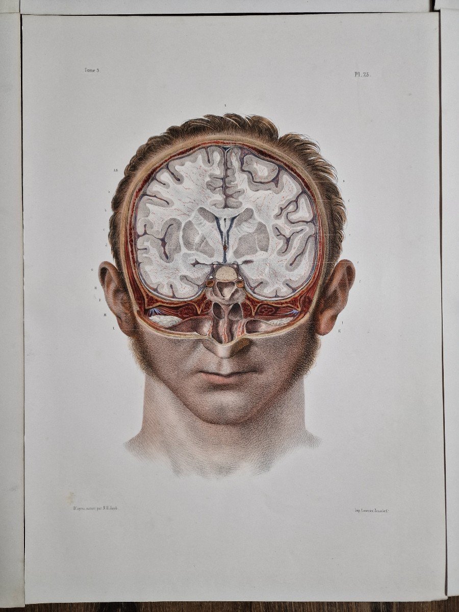 Lot De 6 Gravures Anatomiques Encéphale Par N.h Jacob Traité Anatomique Bourgery Lithographies-photo-1