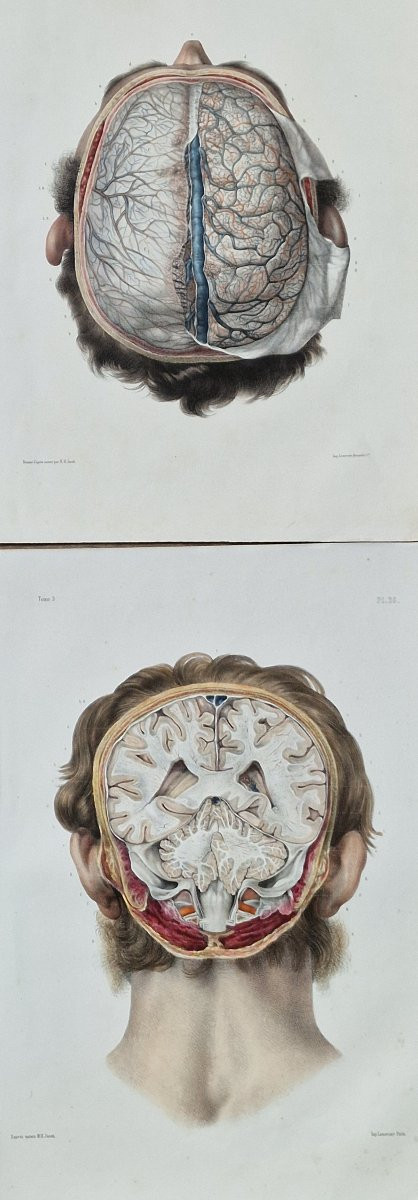 Lot Of Anatomical Engravings From The Medical Treatise By Bourgery And Jacob, Circa 1840, Lot 2-photo-3