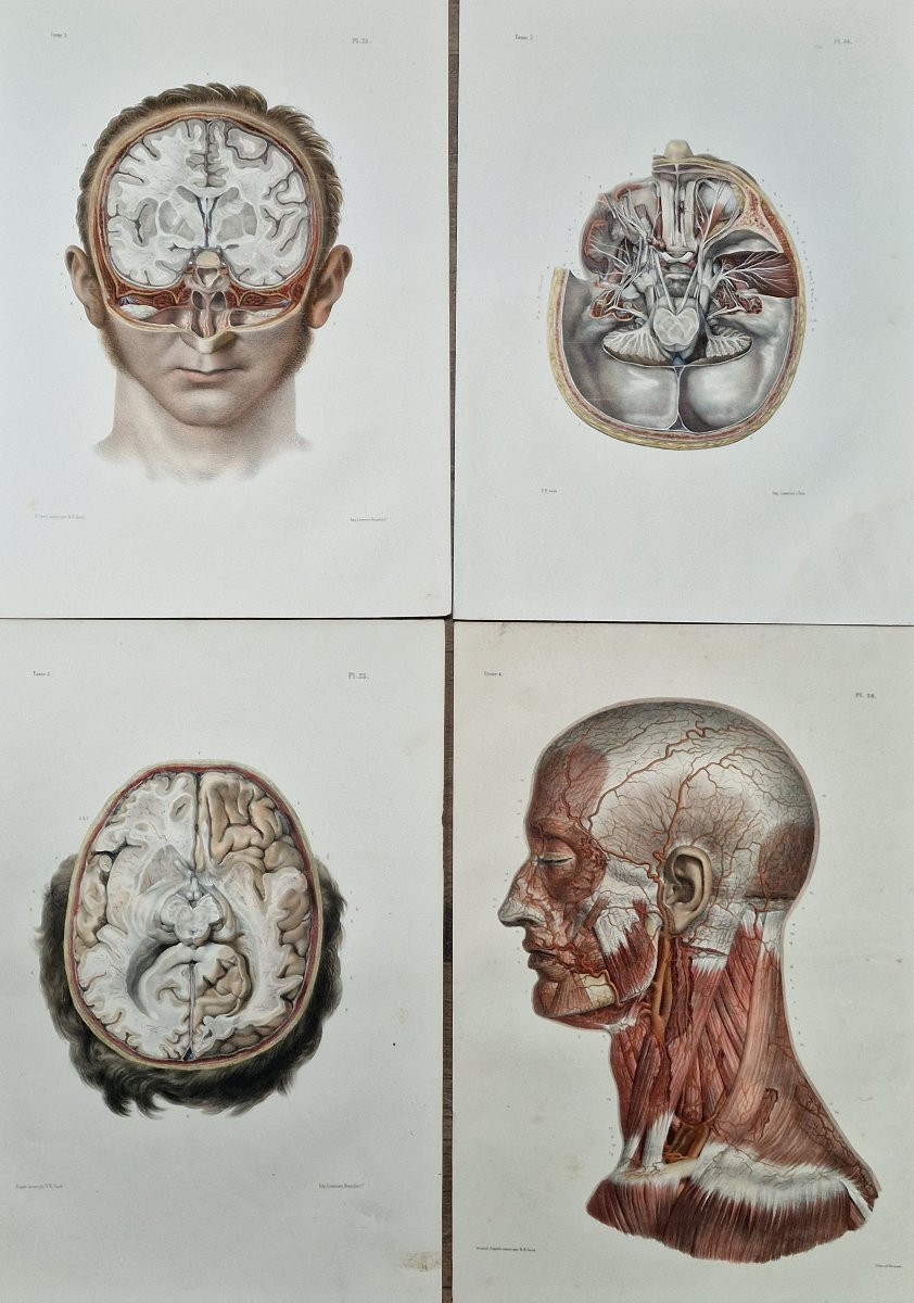 Lot Of Anatomical Engravings From The Medical Treatise By Bourgery And Jacob, Circa 1840, Lot 3-photo-2