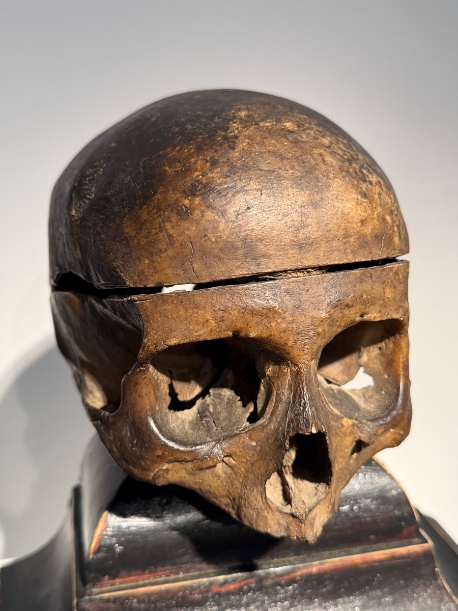 Ancient Anatomical Human Skull-photo-3