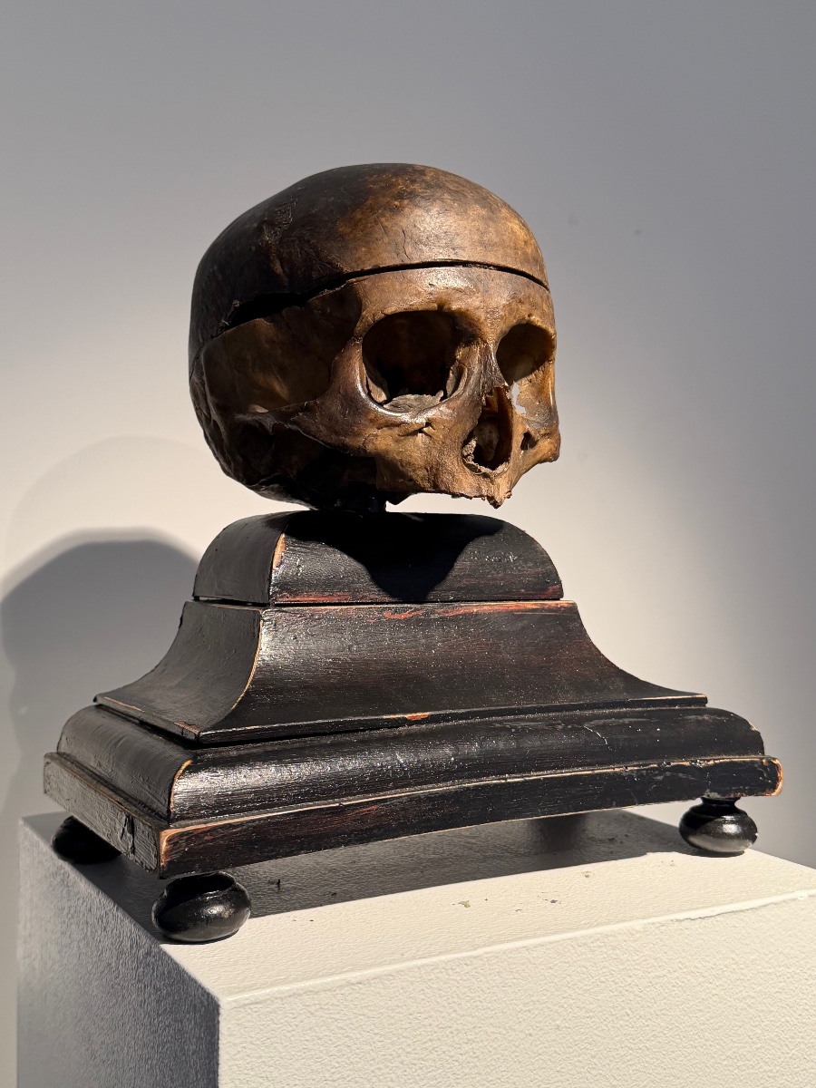 Ancient Anatomical Human Skull-photo-5