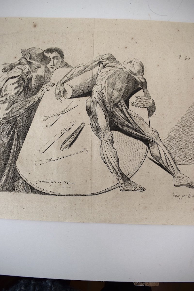 Gravure XVIII Par Jacques Gamelin Gravée Par Lavalée Médecine Anatomie Ref1048-photo-3