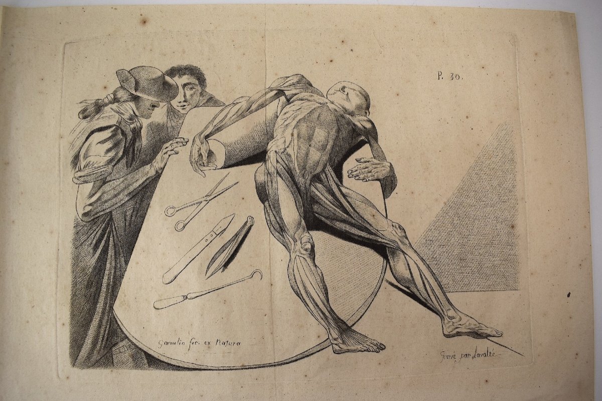 Gravure XVIII Par Jacques Gamelin Gravée Par Lavalée Médecine Anatomie Ref1048