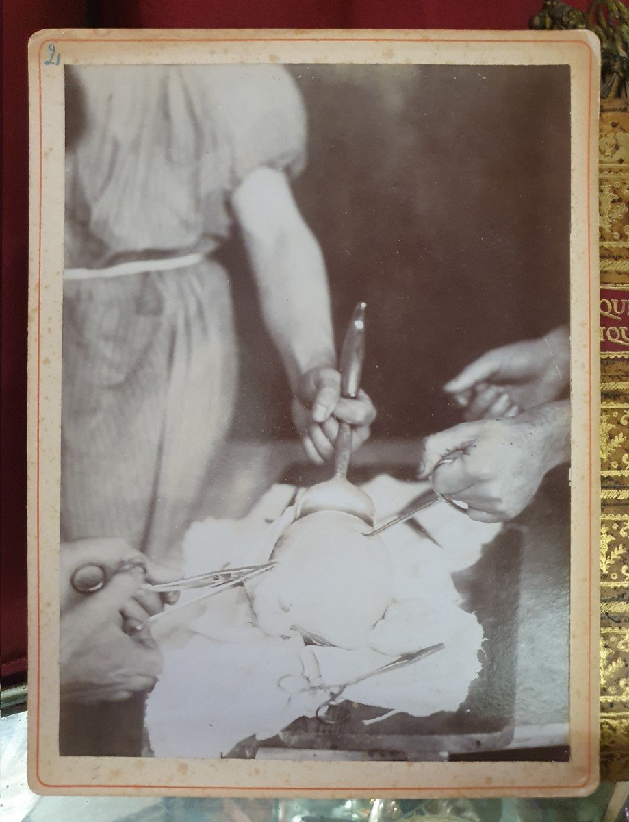 Curiosity: Six Early 20th Century Medical Photographs Of Operations (circa 1900 / 1905)-photo-8