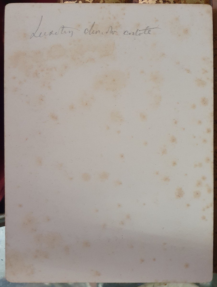 Curiosity: Three Medical Photographs Of A Clinical Case Of Dislocation Following An Accident-photo-4