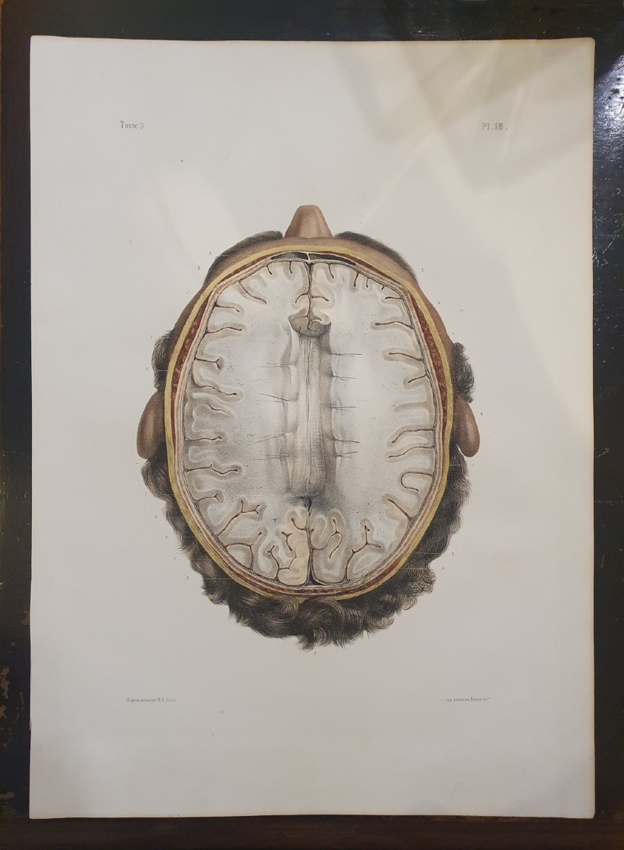 Lithographie Couleur originale circa 1840 Tirée du traité anatomique de Bourgery et Jacob