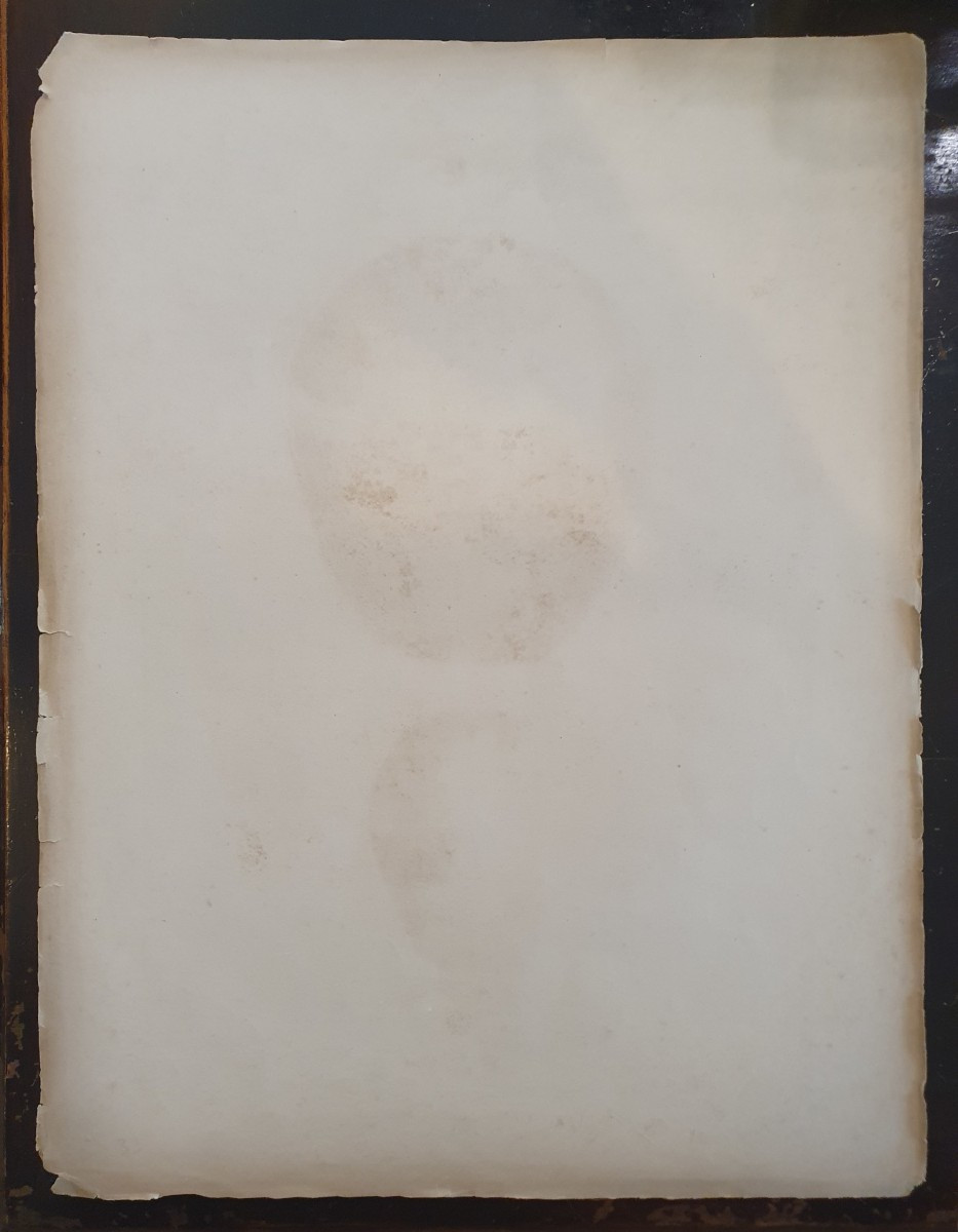 Lithographie ostéologique en noir et blanc originale provenant du tome 1 de Bourgery & Jacob-photo-2