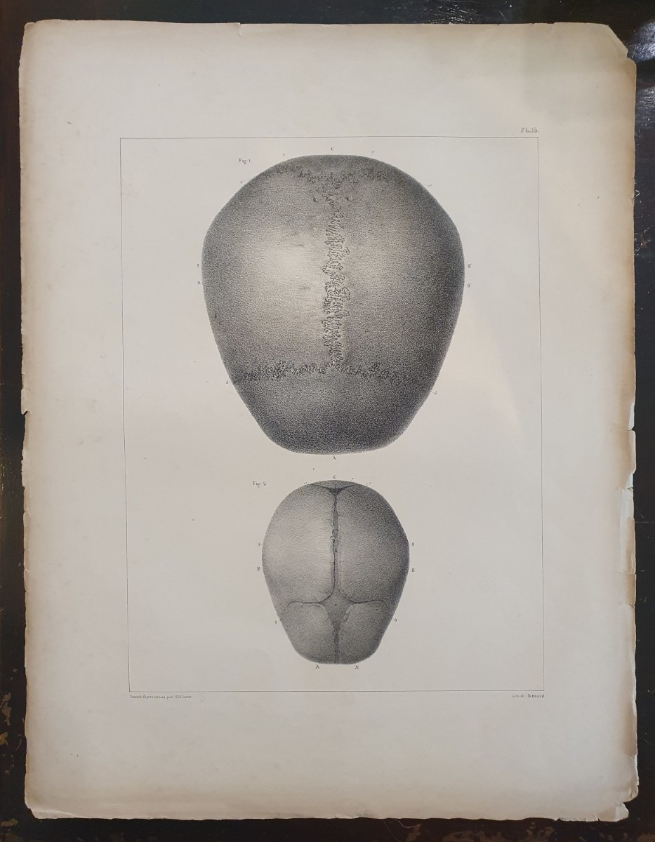 Lithographie ostéologique en noir et blanc originale provenant du tome 1 de Bourgery & Jacob