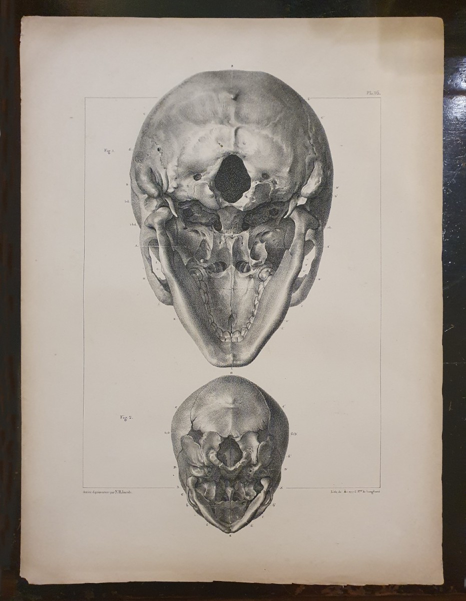 Original Osteological Lithograph Of Two Human Skulls By J-b M Bourgery And N.h. Jacob