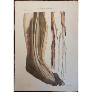 Gravure Couleur Anatomique Pathologique Maladie Gangrène Par Jean Cruveilhier 1839