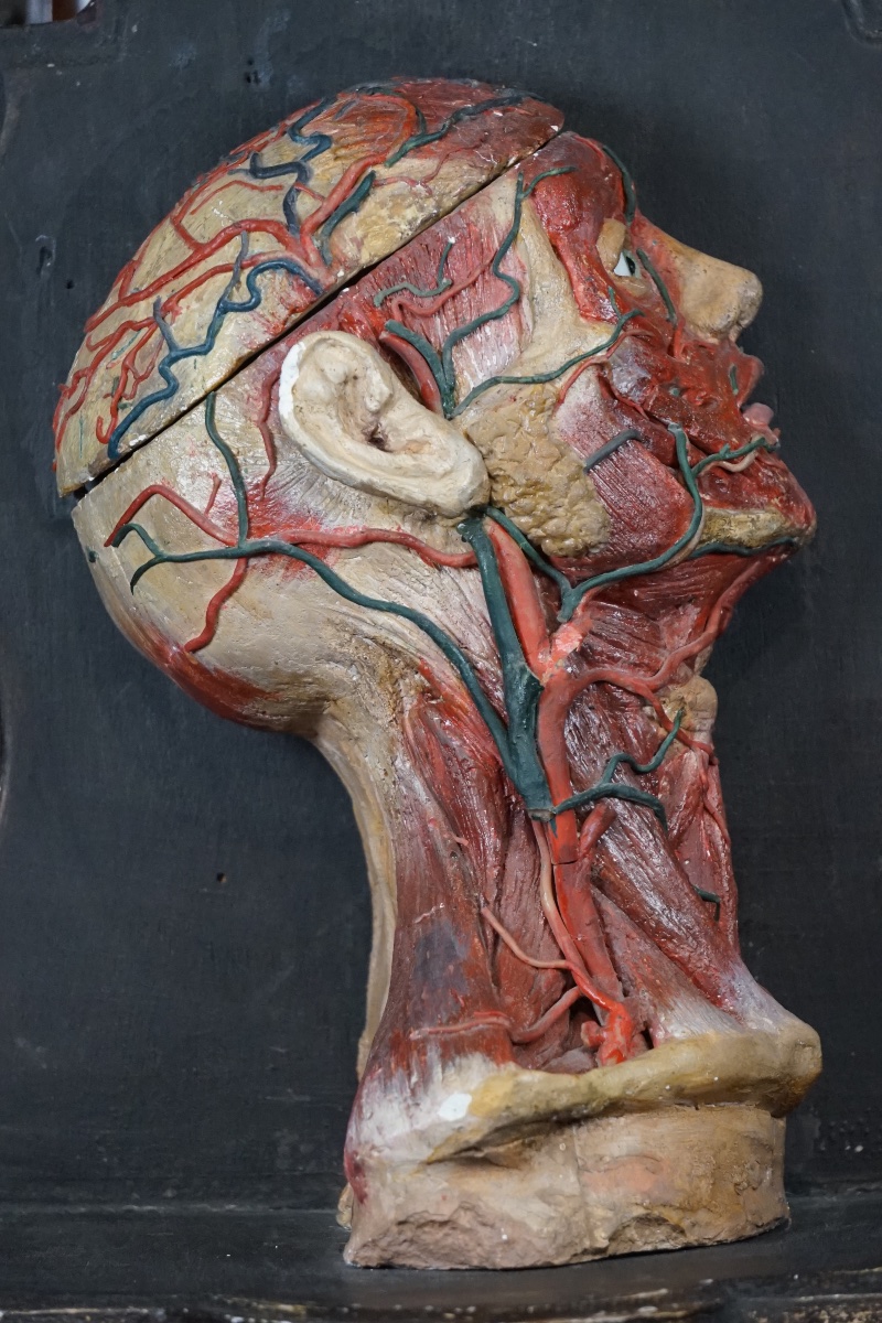 Rare Anatomical Head Of An "écorché" In Stucco And Wax-photo-2