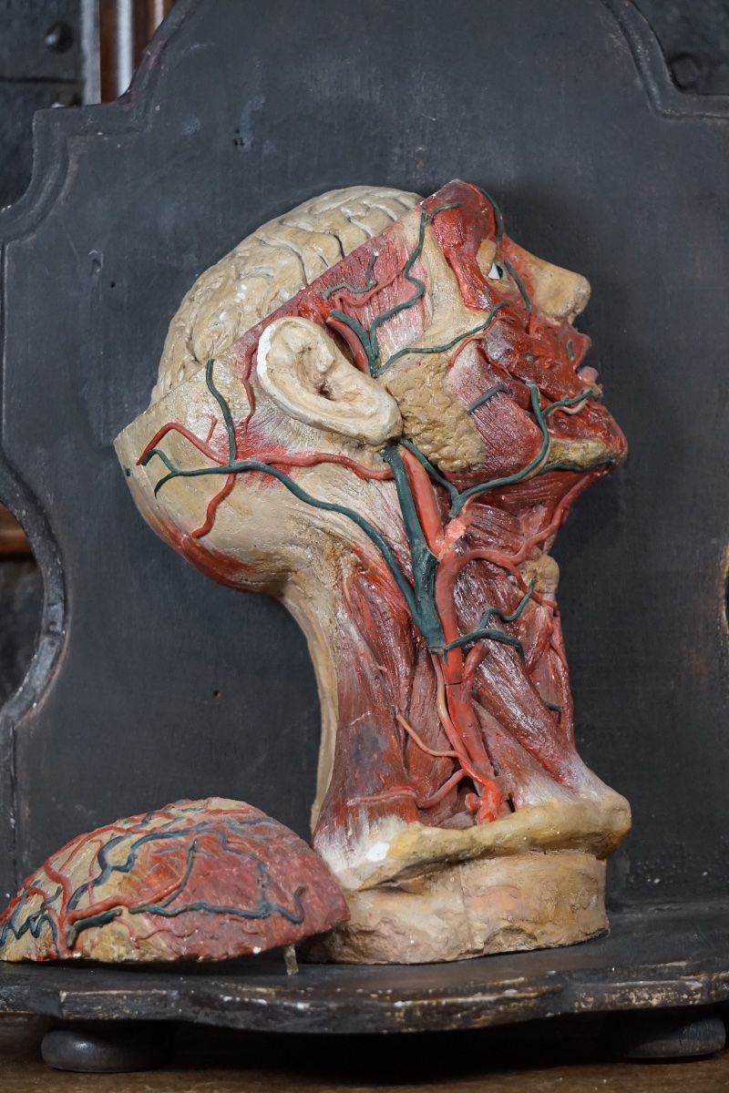 Rare Anatomical Head Of An "écorché" In Stucco And Wax-photo-3