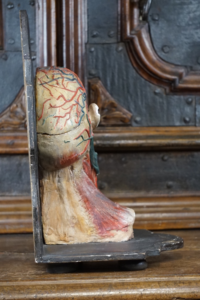 Rare Anatomical Head Of An "écorché" In Stucco And Wax-photo-4