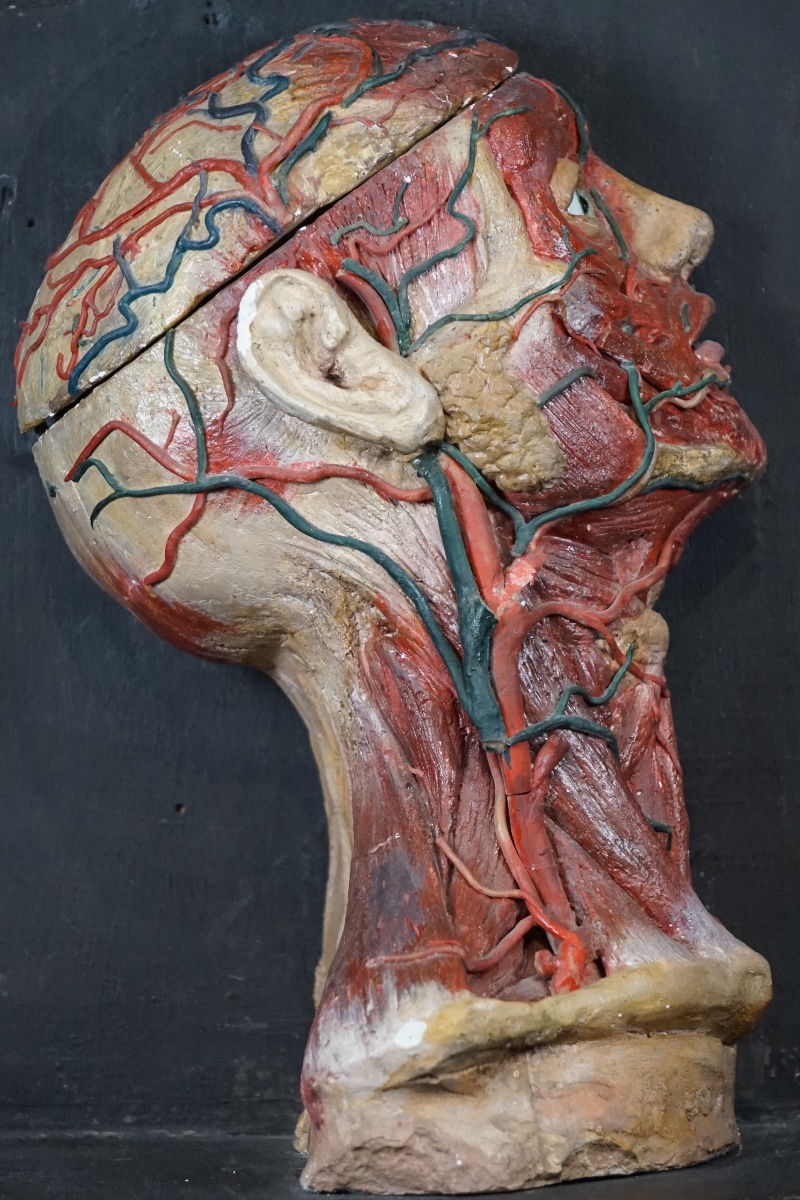 Rare Anatomical Head Of An "écorché" In Stucco And Wax-photo-2