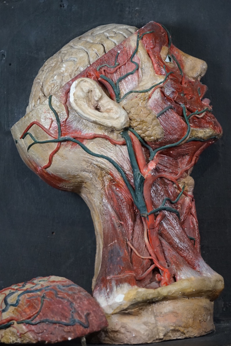 Rare Anatomical Head Of An "écorché" In Stucco And Wax-photo-3