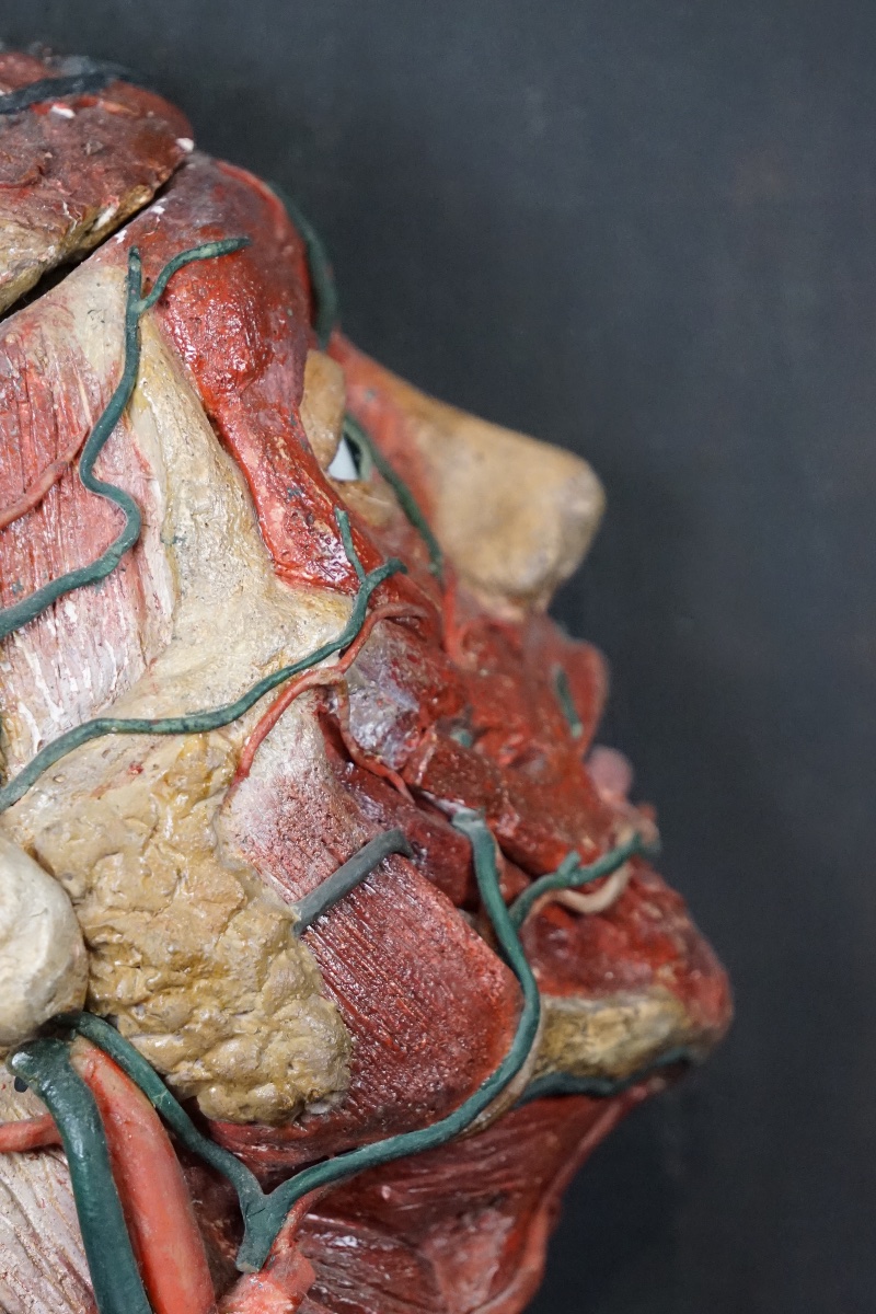 Rare Anatomical Head Of An "écorché" In Stucco And Wax-photo-8