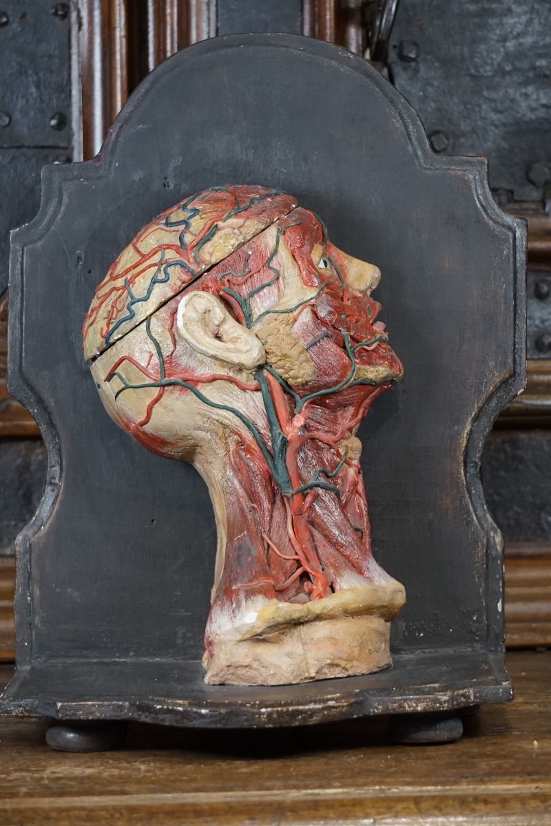 Rare Anatomical Head Of An "écorché" In Stucco And Wax