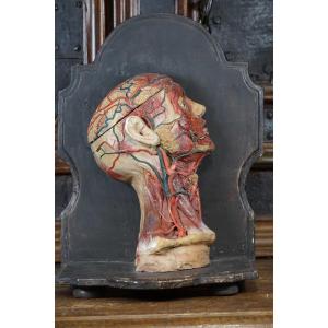 Rare Anatomical Head Of An "écorché" In Stucco And Wax