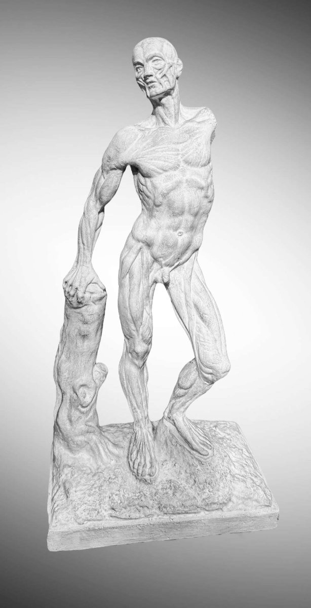 Statue en plâtre Ecorchée ou Dépouillée – Ercole Lelli-photo-2