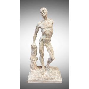 Skinned Or Flayed Plaster Statue – Ercole Lelli