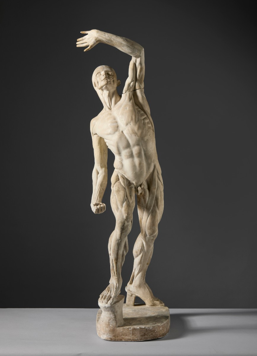 By Jacques - Eugène Caudron (1818–1865) - “ecorché” (fleshed-out Figure) With Raised Arm-photo-2