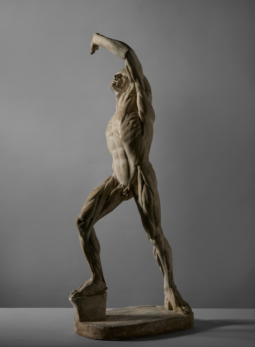 By Jacques - Eugène Caudron (1818–1865) - “ecorché” (fleshed-out Figure) With Raised Arm-photo-3