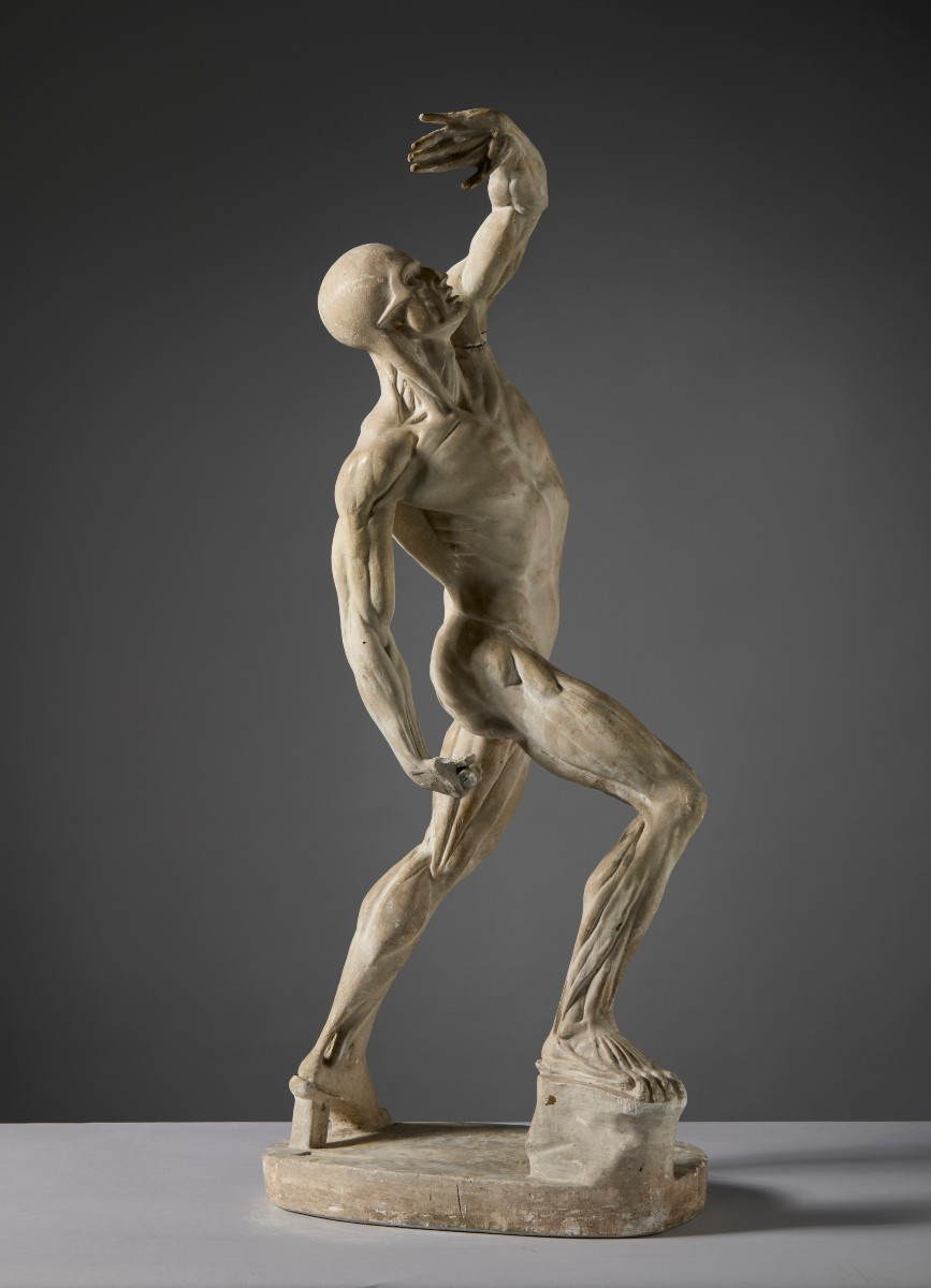 By Jacques - Eugène Caudron (1818–1865) - “ecorché” (fleshed-out Figure) With Raised Arm-photo-3