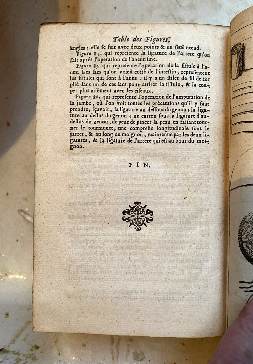 Beautiful "complete Treatise On Surgical Operations" In Paris By Mr. De La Vauguion, Et. Michalet-photo-1