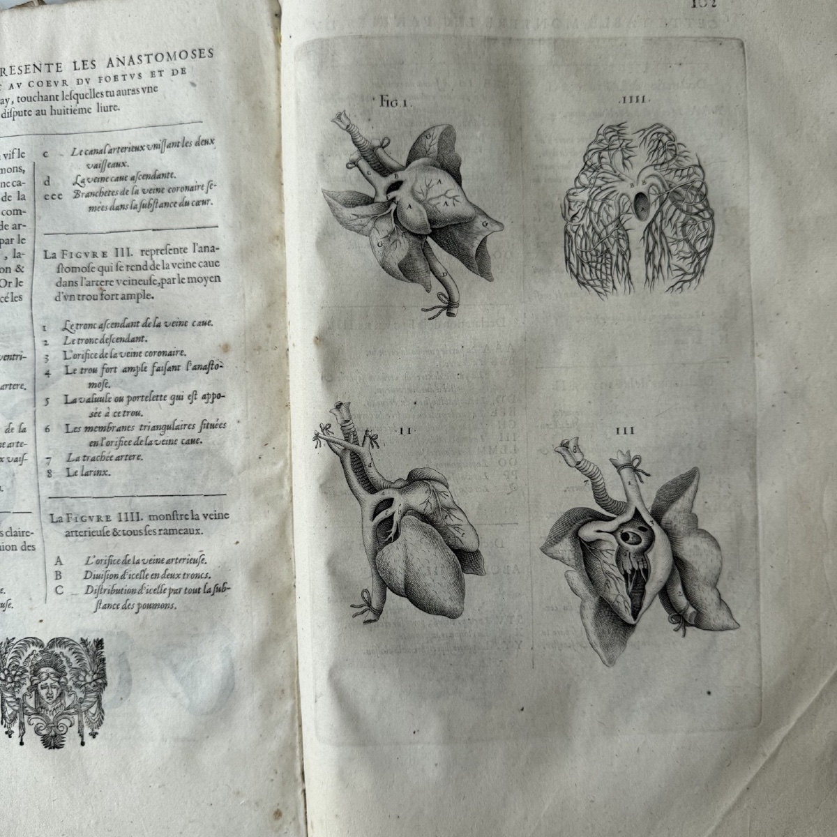 The Complete Anatomical Works Of André Du Laurens, Dated 1621 -photo-3