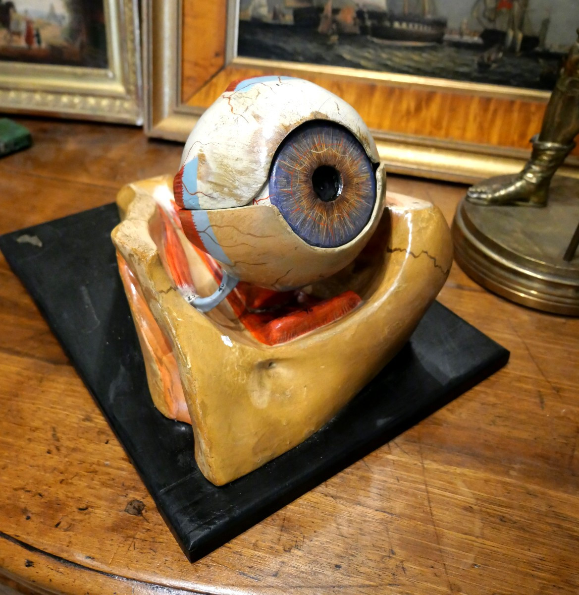 Ecorché d'un oeil anatomique début XXe 