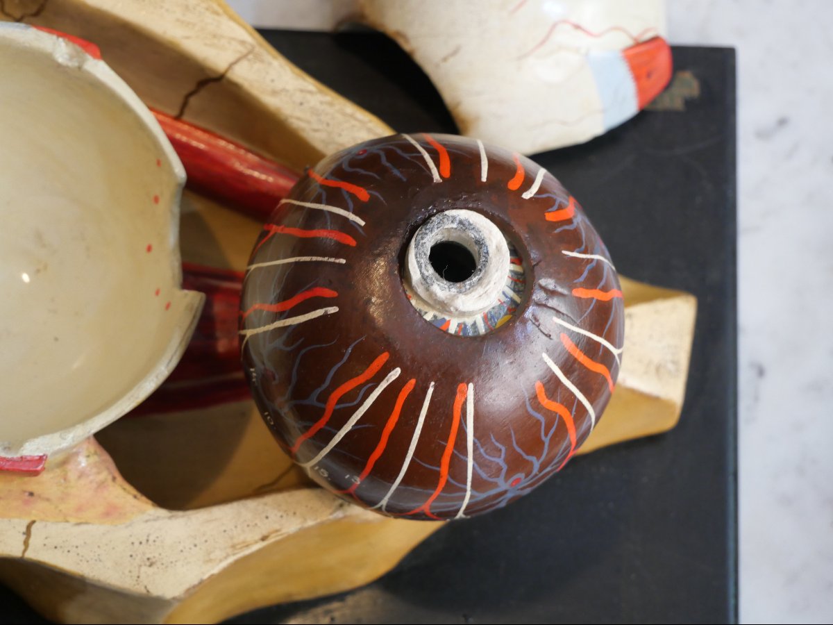 Ecorché d'un oeil anatomique début du XXe -photo-4