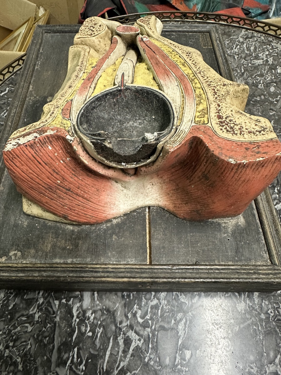 Modèle D Anatomie Coupe D Un œil Par Deyrolle Fils Rue Du Bac 19e-photo-2