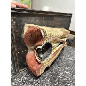 Modèle D Anatomie Coupe D Un œil Par Deyrolle Fils Rue Du Bac 19e
