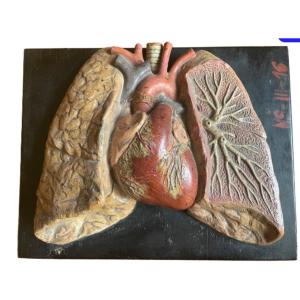 Beautiful Flayed Heart And Lungs Painted Plaster 19th