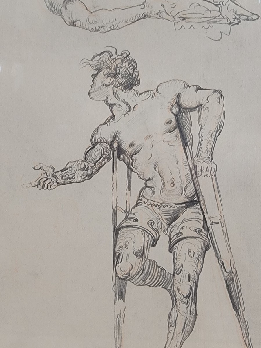 Young Man On Crutches -photo-3