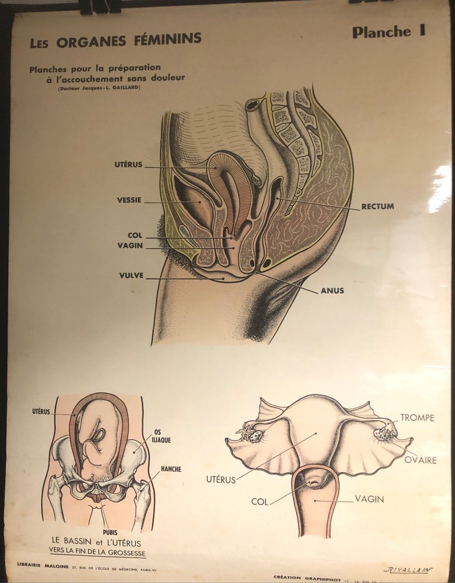 RARE 4 Planches Préparation à l’accouchement sans douleur Grossesse Sage Femme Medecine Rivallain XIXe/XXe-photo-2