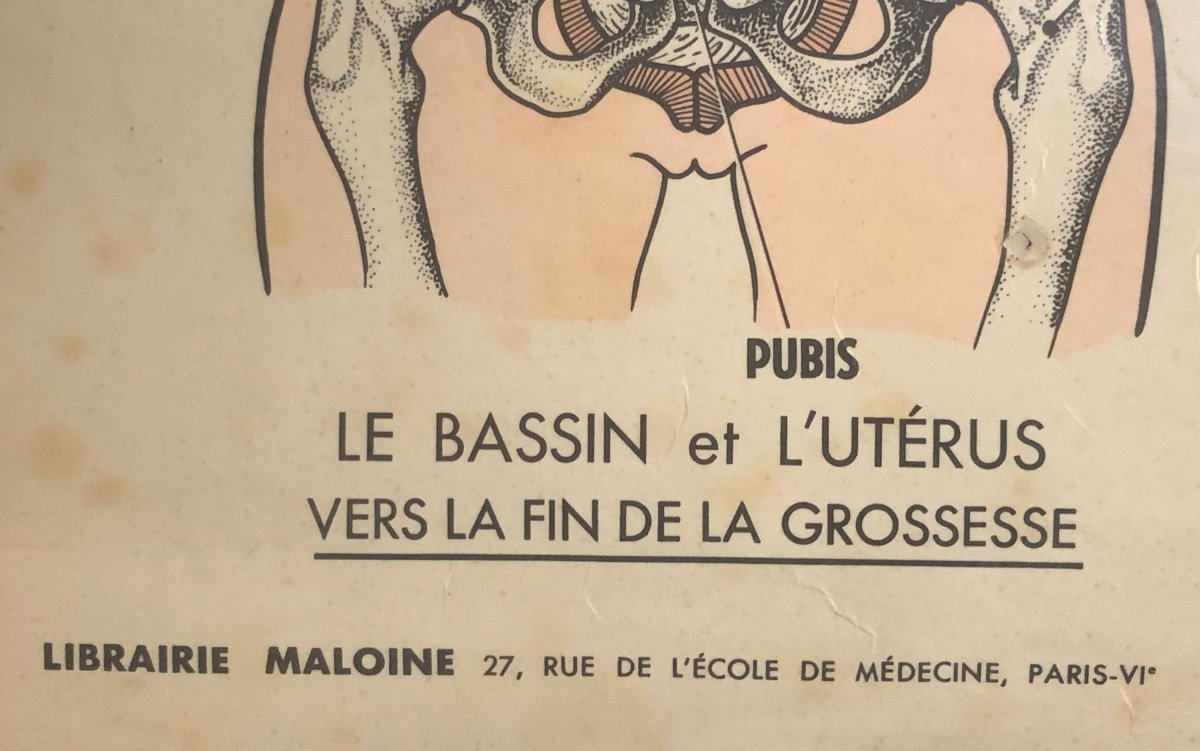 RARE 4 Planches Préparation à l’accouchement sans douleur Grossesse Sage Femme Medecine Rivallain XIXe/XXe-photo-1