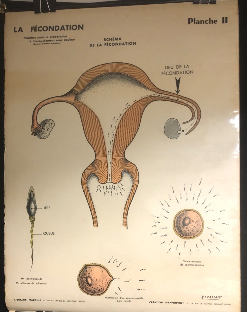 RARE 4 Planches Préparation à l’accouchement sans douleur Grossesse Sage Femme Medecine Rivallain XIXe/XXe-photo-3