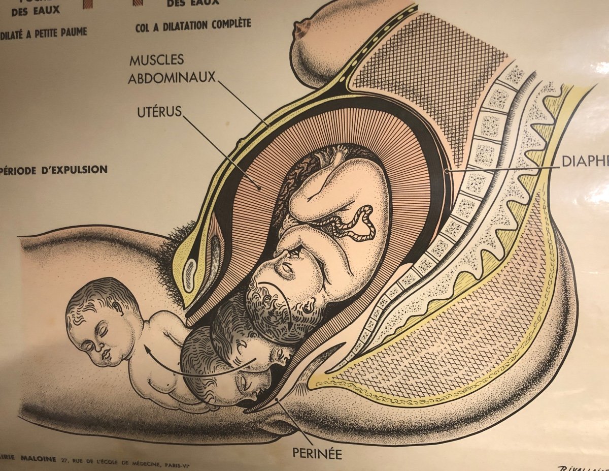 Rare 4 Plates Childbirth Preparation Painless Pregnancy Midwife Medicine Rivallain XIXth/xxth-photo-6