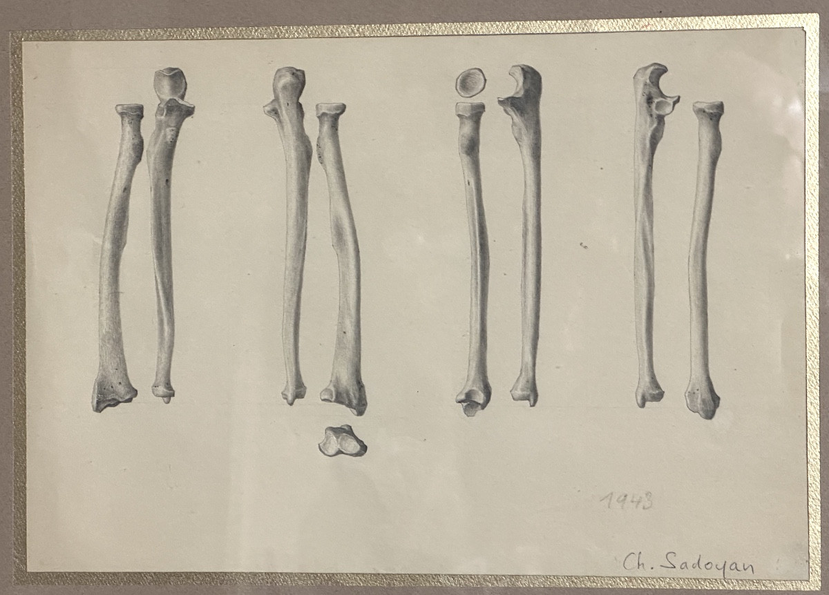 Ch. Sadoyan 1943 Study Of Framed Bones Cabinet Of Curiosities Medicine-photo-2