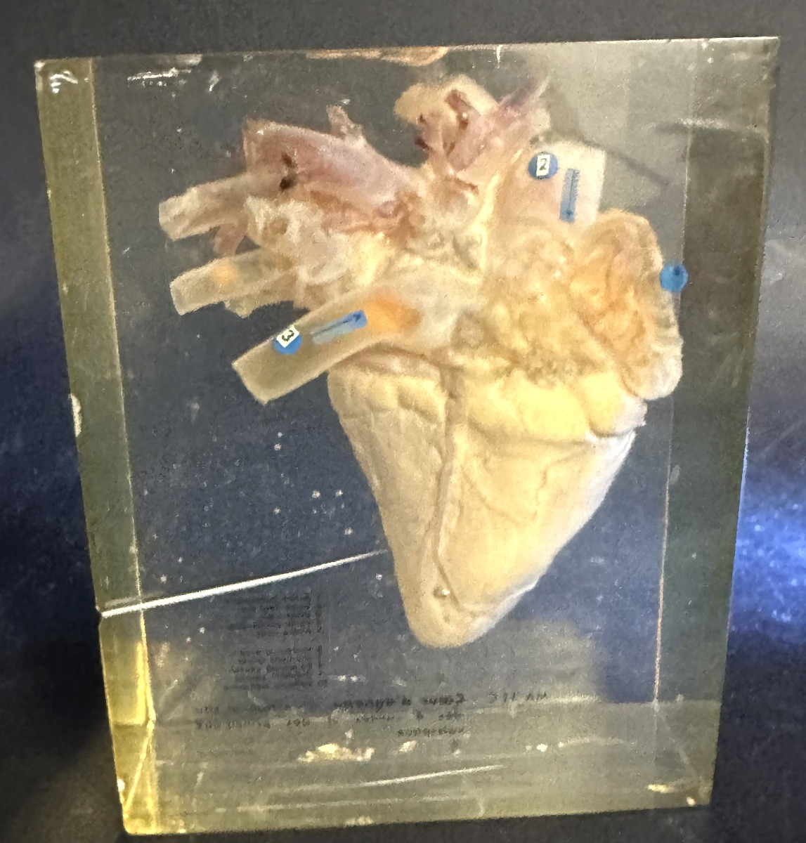 Rare cœur d’agneau en inclusion dans un bloc de résine altuglas Curiosité -photo-3