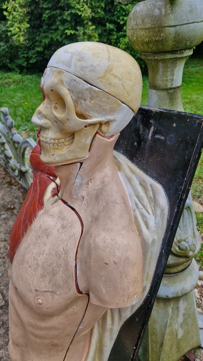 Ecorché Médical Ancien-photo-3