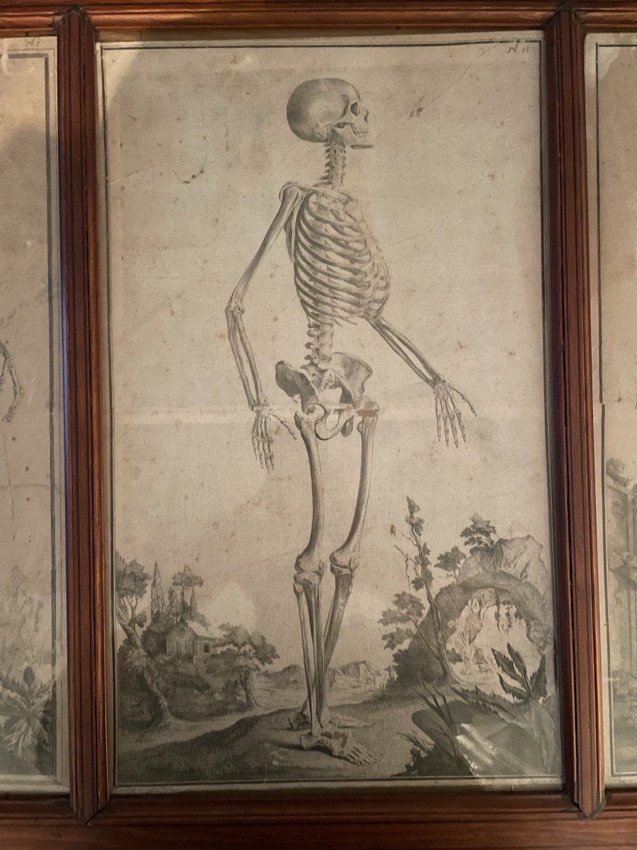 3 Skeletons - Anatomical Engravings In An XIX Pitchpin Frame-photo-3