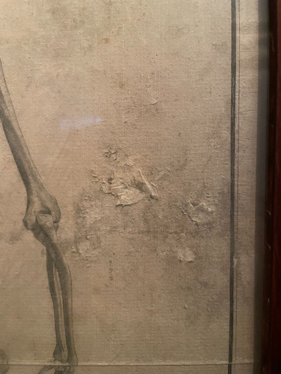 3 squelettes - gravures anatomiques dans un encadrement XIX en pitchpin -photo-1