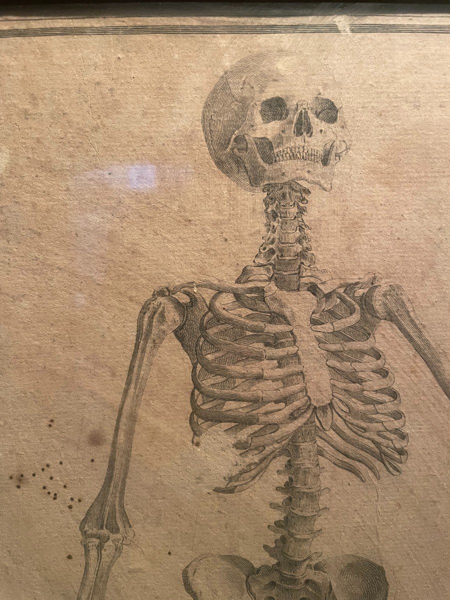 3 squelettes - gravures anatomiques dans un encadrement XIX en pitchpin -photo-4