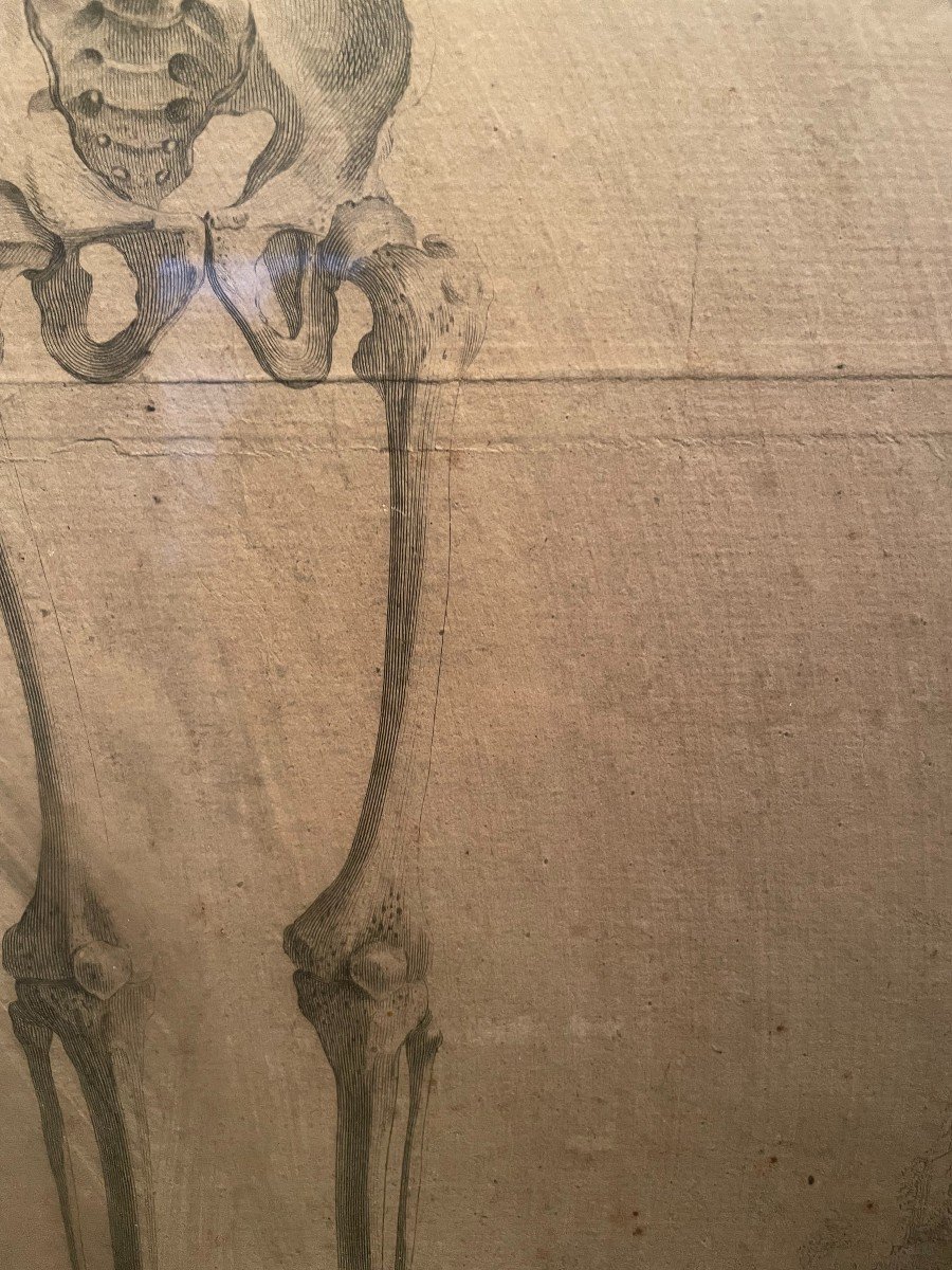 3 squelettes - gravures anatomiques dans un encadrement XIX en pitchpin -photo-8
