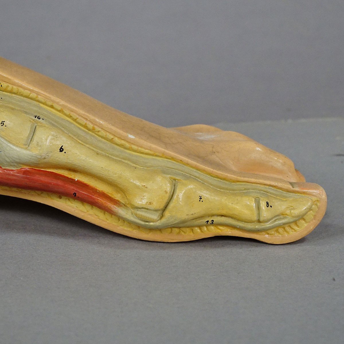Modèle Anatomique De Pied Antique En 3d Fabriqué Par Somso Vers 1930-photo-3