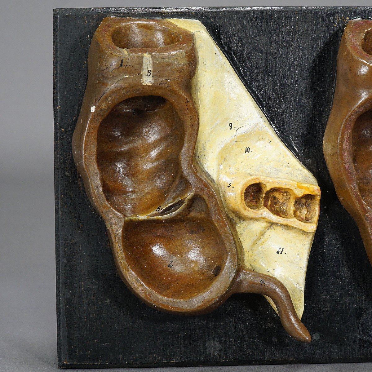 Antique Teaching Model Stages Of The Appendix, Ca. 1900-photo-4