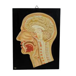 Antique Teaching Aid - Midline Incision Of The Human Head By Phywe